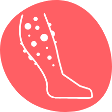 Röd cirkel med ett vitt illustrerat ben med knölar på